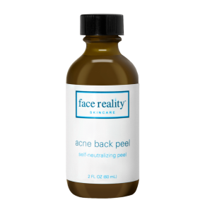 Acne Peel for the Back