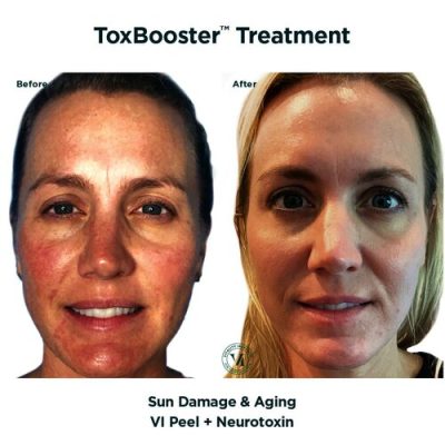 toxbooster2